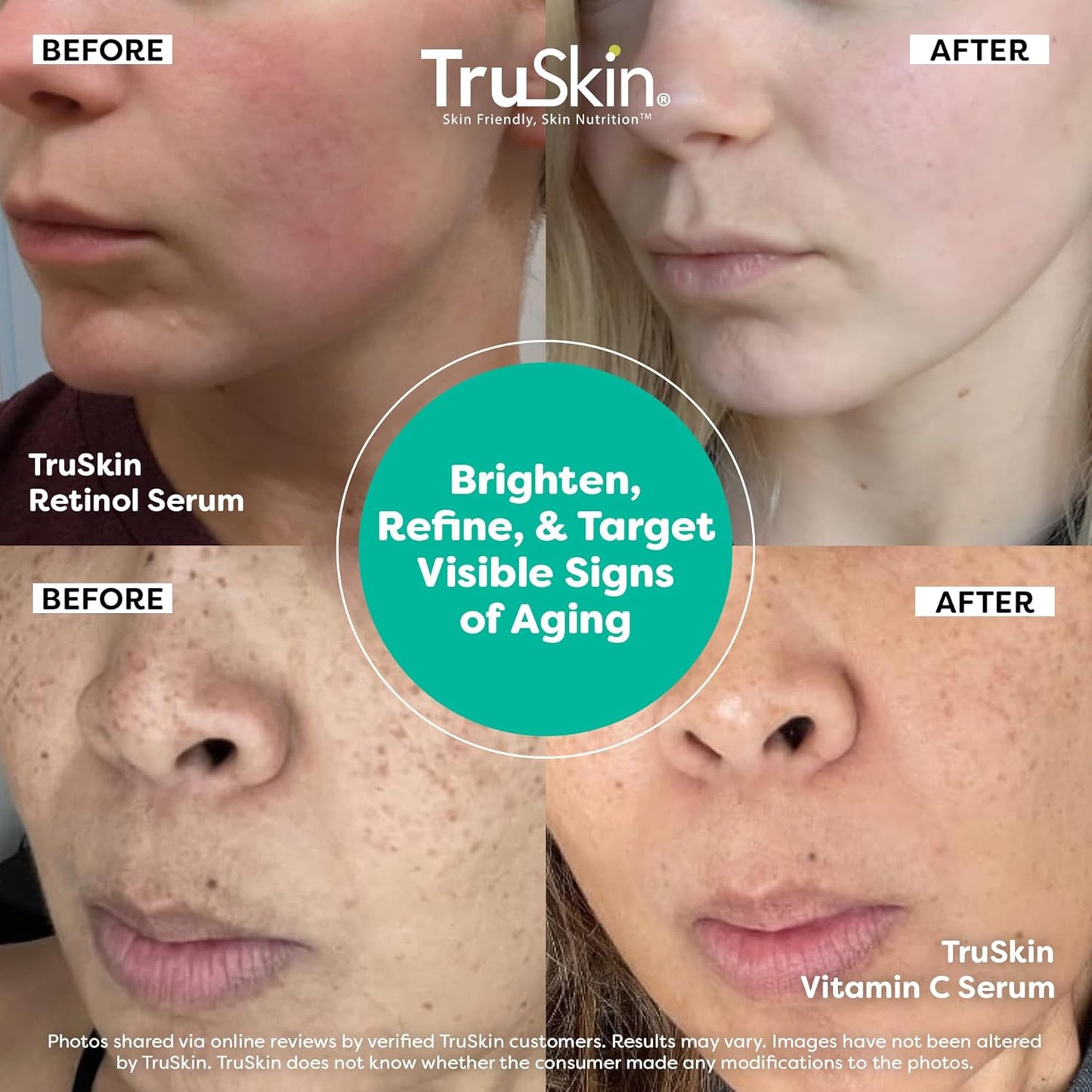 TruSkin Face Serum Duo – Vitamin C & Retinol Serum for Face – Anti-Aging Skin Care Gift Set for Women – Helps Improve Appearance of Fine Lines & Wrinkles for Smoother Looking Skin, 1 Fl Oz, 2 Bottles