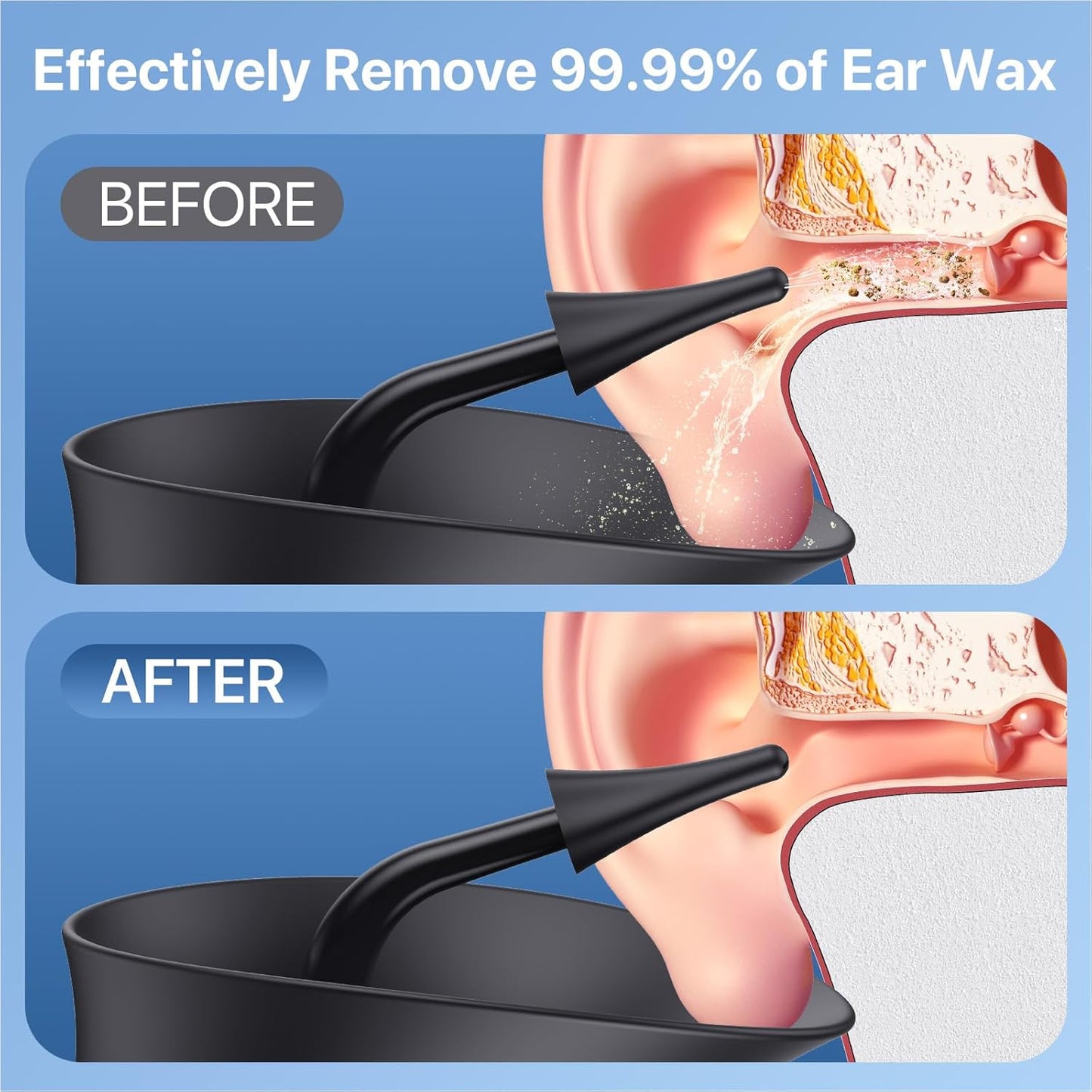 Ear Wax Removal, Upgraded Dual Water Tank Electric Ear Cleaner, IPX6 Waterproof Ear Cleaning Kit with Water Temperature Sensor Effective & Safe Ear Wax Removal Kit, 4 Pressure Modes & USB-C Cable