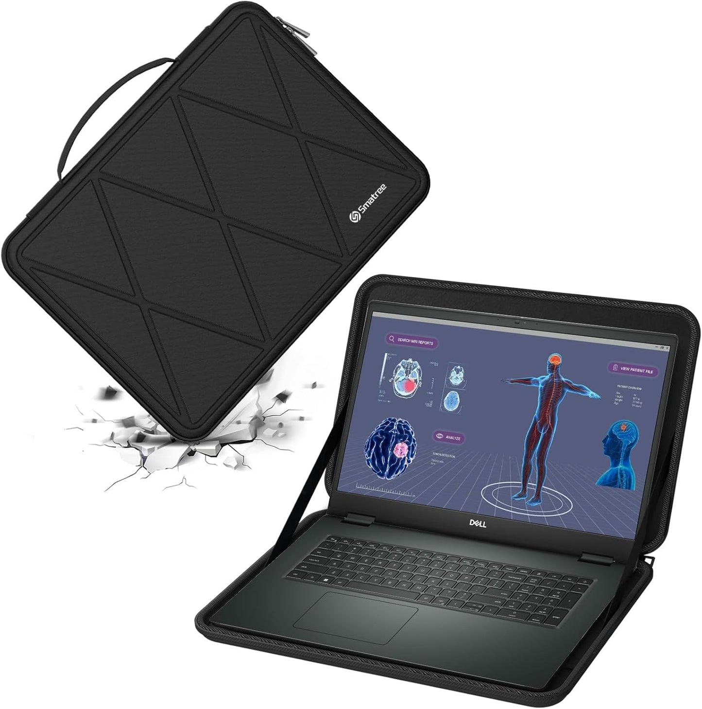 Smatree Hard EVA Protective Sleeve Case Compatible for 17.3 inch DELL Precision 7780 Workstation/Precision 7770 Workstation (X8325)