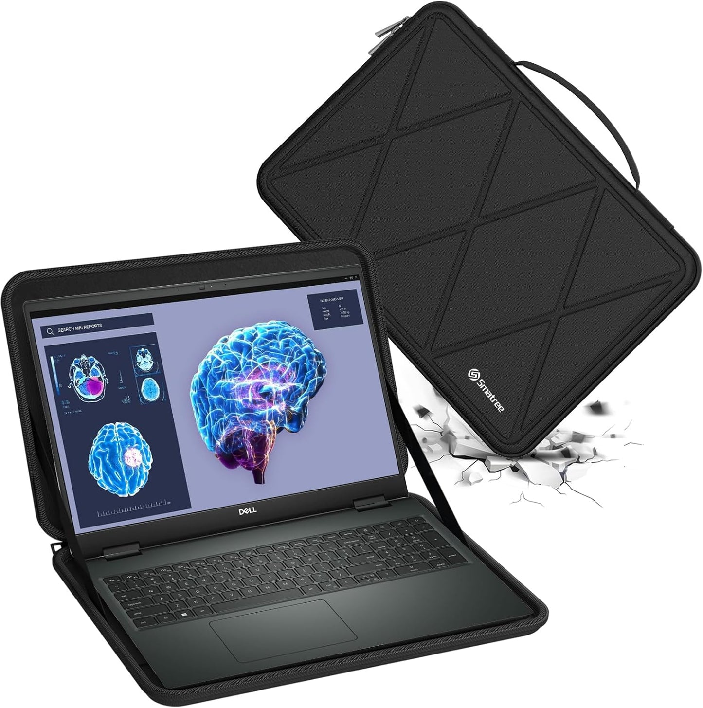 Smatree Hard EVA Protective Sleeve Case Compatible for 16 inch DELL Pro Max 16 Plus MB16250,for 16 inch Alienware 16/16X Aurora Gaming Laptop,for 16inch Precision 7680/7670 Workstation Laptop (X8287)